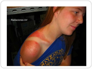 Radiaciones UV 