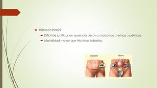  Histerectomía.
 Difícil de justificar en ausencia de otros trastornos uterinos o pélvicos.
 Mortalidad mayor que técnicas tubarias.
 
