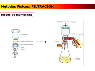 Discos de membrana
Métodos Físicos: FILTRACION
 