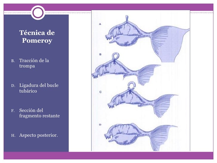 Esterilizacion Seminario (Hnerm)