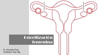 1
Esterilización
femenina
Dr. Sócrates Pozo
Verdesoto. Esp; Mg.
 