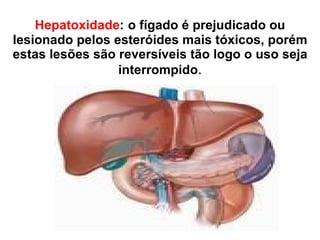 Hepatoxidade :   o fígado é prejudicado ou lesionado pelos esteróides mais tóxicos, porém estas lesões são reversíveis tão logo o uso seja interrompido . 