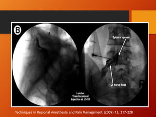 Techniques in Regional Anesthesia and Pain Management (2009) 13, 217-228
 