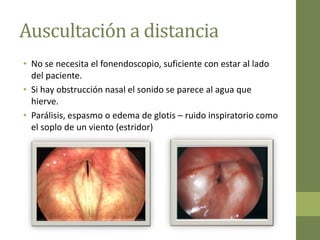 Auscultación a distancia
• No se necesita el fonendoscopio, suficiente con estar al lado
  del paciente.
• Si hay obstrucción nasal el sonido se parece al agua que
  hierve.
• Parálisis, espasmo o edema de glotis – ruido inspiratorio como
  el soplo de un viento (estridor)
 