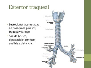 Estertor traqueal

• Secreciones acumuladas
  en bronquios gruesos,
  tráquea y laringe
• Sonido brusco,
  desapacible, confuso,
  audible a distancia.
 