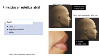 Principios en estética labial
• Línea E
• Angulo nasolabial
• Labios
Perfil
Labio sup:4mm
Labio inf: 2mm
H: 90-95%
M: 100-105%
Frediani. Análisis estético. Milán. Quintensse. 2006
Punta nariz- subnasal – labio sup
Punta nariz - Pogonion
 