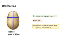 Dolicocefalo
Menos 76%
El cráneo es mas largo que ancho
IC= Diametro transversal máximo X100
Diámetro anteroposterior
 