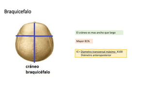Braquicefalo
Mayor 81%
El cráneo es mas ancho que largo
IC= Diametro transversal máximo X100
Diámetro anteroposterior
 