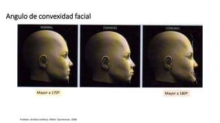 Angulo de convexidad facial
Mayor a 180º
Mayor a 170º
Frediani. Análisis estético. Milán. Quintensse. 2006
 