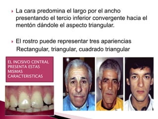  La cara predomina el largo por el ancho 
presentando el tercio inferior convergente hacia el 
mentón dándole el aspecto triangular. 
 El rostro puede representar tres apariencias 
Rectangular, triangular, cuadrado triangular 
EL INCISIVO CENTRAL 
PRESENTA ESTAS 
MISMAS 
CARACTERISTICAS 
 
