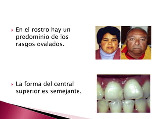  En el rostro hay un 
predominio de los 
rasgos ovalados. 
 La forma del central 
superior es semejante. 
 