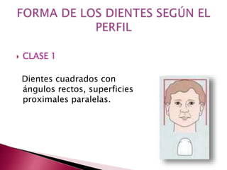  CLASE 1 
Dientes cuadrados con 
ángulos rectos, superficies 
proximales paralelas. 
 