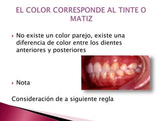  No existe un color parejo, existe una 
diferencia de color entre los dientes 
anteriores y posteriores 
 Nota 
Consideración de a siguiente regla 
 