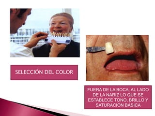 SELECCIÓN DEL COLOR 
FUERA DE LA BOCA, AL LADO 
DE LA NARIZ LO QUE SE 
ESTABLECE TONO, BRILLO Y 
SATURACIÓN BÁSICA 
 