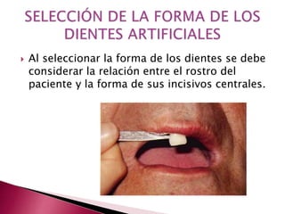  Al seleccionar la forma de los dientes se debe 
considerar la relación entre el rostro del 
paciente y la forma de sus incisivos centrales. 
 