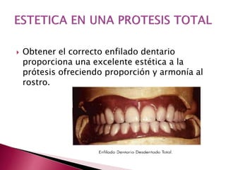 Obtener el correcto enfilado dentario 
proporciona una excelente estética a la 
prótesis ofreciendo proporción y armonía al 
rostro. 
 