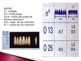 DATOS 
O= ovalado 
25= N del juego 
42,8= ancho del juego de 
dientes anteriores 
9.9= largo de los centrales 
8,1= ancho de los centrales 
 