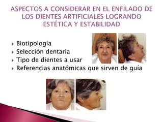  Biotipología 
 Selección dentaria 
 Tipo de dientes a usar 
 Referencias anatómicas que sirven de guía 
 