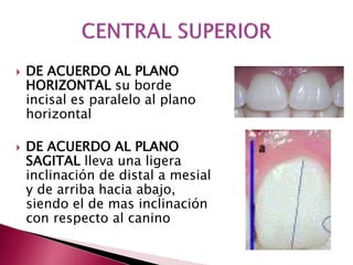  DE ACUERDO AL PLANO 
HORIZONTAL su borde 
incisal es paralelo al plano 
horizontal 
 DE ACUERDO AL PLANO 
SAGITAL lleva una ligera 
inclinación de distal a mesial 
y de arriba hacia abajo, 
siendo el de mas inclinación 
con respecto al canino 
 