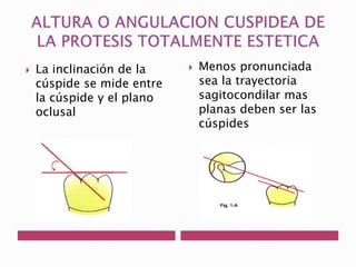  La inclinación de la 
cúspide se mide entre 
la cúspide y el plano 
oclusal 
 Menos pronunciada 
sea la trayectoria 
sagitocondilar mas 
planas deben ser las 
cúspides 
 