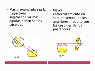 Mas pronunciada sea la 
trayectoria 
sagitocondilar mas 
agudas deben ser las 
cúspides 
 Mayor 
entrecruzamiento en 
sentido vertical de los 
anteriores mas alta son 
las cúspides de los 
posteriores 
 
