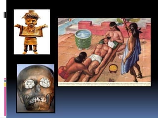 Estetica y el arte