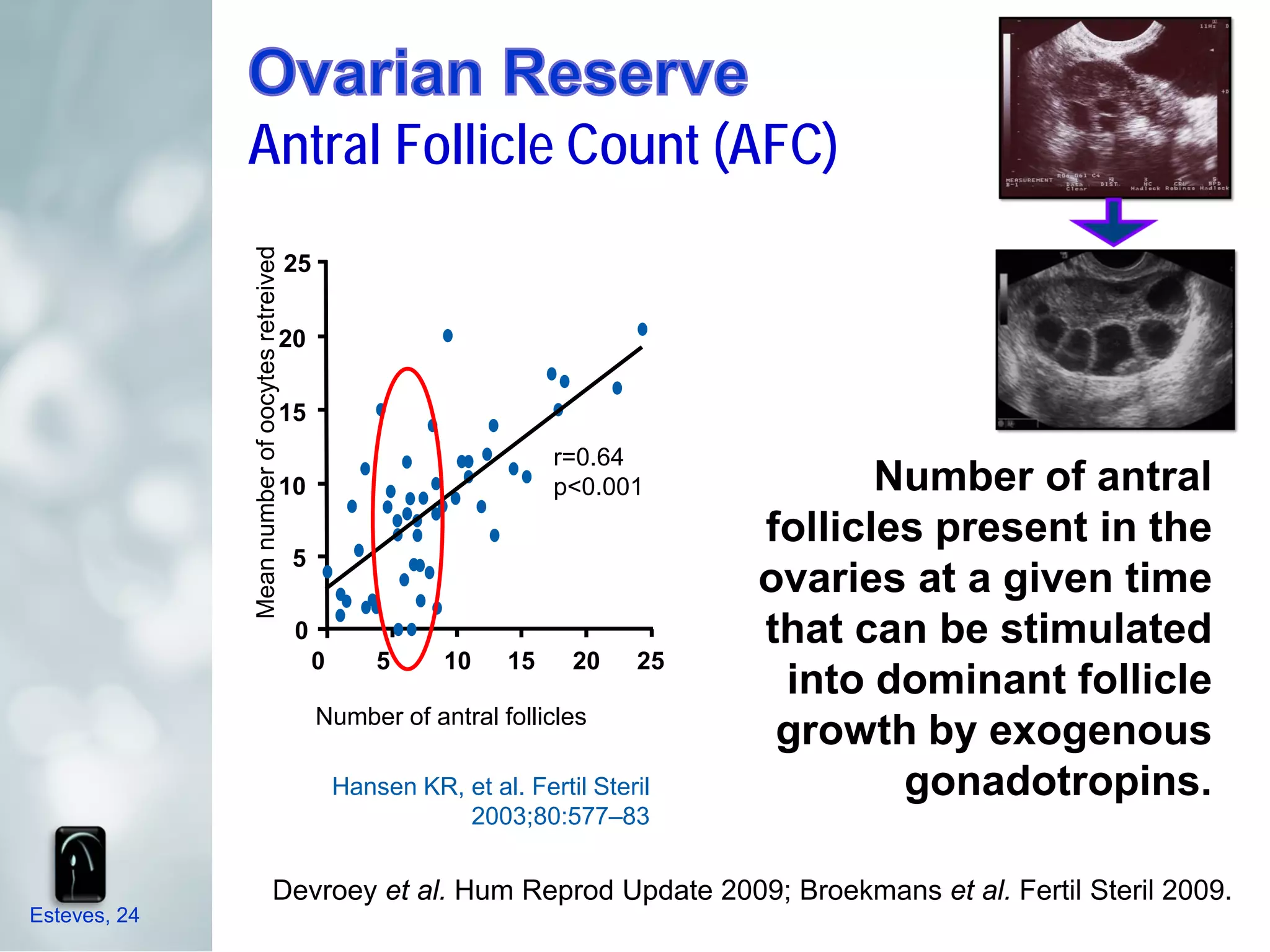 Antral Follicle Count (AFC)
              Mean number of oocytes retreived   25


                                             20

                                             15
                                                                                r=0.64
                                             10                                 p<0.001            Number of antral
                                                                                            follicles present in the
                                                 5
                                                                                            ovaries at a given time
                                                 0                                          that can be stimulated
                                                      0       5     10     15    20    25
                                                                                             into dominant follicle
                                                      Number of antral follicles
                                                                                             growth by exogenous
                                                          Hansen KR, et al. Fertil Steril           gonadotropins.
                                                                     2003;80:577–83


                                    Devroey et al. Hum Reprod Update 2009; Broekmans et al. Fertil Steril 2009.
Esteves, 24
 