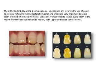 The esthetic dentistry, using a combination of science and art, involves the use of colors
to create a natural tooth like restoration, color and shade are very important because
teeth are multi-chromatic with color variations from cervical to incisal, every tooth in the
mouth from the central incisors to molars, both upper and lower, varies in color.
 