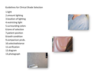 Guidelines for Clinical Shade Selection
1.light
2.amount lighting
3.location of lighting
4.restricting light
5.surrounding colors
6.tone of selection
7.patient position
8.tooth condition
9.comparison prcds.
10.selectiodistance
11.verification
12.diagram
13.photograph
 
