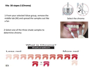 Vita 3D stapes 2 (Chroma)
Select the chroma
1-From your selected Value group, remove the
middle tab (M) and spread the samples out like
a fan
2-Select one of the three shade samples to
determine chroma
 