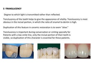 5 -TRANSLUCENCY
Translucency of the tooth helps to give the appearance of vitality. Translucency is most
obvious in the incisal portion, in which the ratio of enamel to dentin is high.
Duplication of this feature in ceramic restoration is to seem “alive.”
Translucency is important during conversation or smiling specially for
Patients with a low smile line, only the incisal portion of their teeth is
visible, so duplication of this character is essential for these patients.
Degree to which light is transmitted rather than reflected.
 