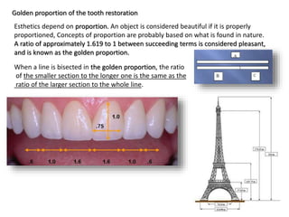 Esthetics depend on proportion. An object is considered beautiful if it is properly
proportioned, Concepts of proportion are probably based on what is found in nature.
A ratio of approximately 1.619 to 1 between succeeding terms is considered pleasant,
and is known as the golden proportion.
Golden proportion of the tooth restoration
When a line is bisected in the golden proportion, the ratio
of the smaller section to the longer one is the same as the
ratio of the larger section to the whole line.
 