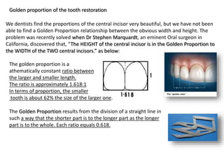 We dentists find the proportions of the central incisor very beautiful, but we have not been
able to find a Golden Proportion relationship between the obvious width and height. The
problem was recently solved when Dr Stephen Marquardt, an eminent Oral surgeon in
California, discovered that, “The HEIGHT of the central incisor is in the Golden Proportion to
the WIDTH of the TWO central incisors.” as below:
Golden proportion of the tooth restoration
The golden proportion is a
athematically constant ratio between
the larger and smaller length.
The ratio is approximately 1.618:1
In terms of proportion, the smaller
tooth is about 62% the size of the larger one.
The Golden Proportion results from the division of a straight line in
such a way that the shorter part is to the longer part as the longer
part is to the whole. Each ratio equals 0.618.
 