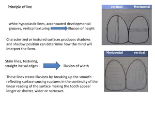Principle of line
white hypoplastic lines, accentuated developmental
grooves, vertical texturing illusion of height
Stain lines, texturing,
straight incisal edges illusion of width
These lines create illusions by breaking up the smooth
reflecting surface causing ruptures in the continuity of the
linear reading of the surface making the tooth appear
longer or shorter, wider or narrower.
Characterized or textured surfaces produces shadows
and shadow position can determine how the mind will
interpret the form.
 