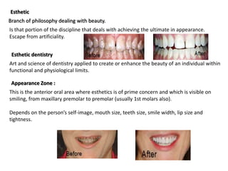 Is that portion of the discipline that deals with achieving the ultimate in appearance.
Escape from artificiality.
Esthetic
Branch of philosophy dealing with beauty.
Art and science of dentistry applied to create or enhance the beauty of an individual within
functional and physiological limits.
Esthetic dentistry
Appearance Zone :
This is the anterior oral area where esthetics is of prime concern and which is visible on
smiling, from maxillary premolar to premolar (usually 1st molars also).
Depends on the person’s self-image, mouth size, teeth size, smile width, lip size and
tightness.
 