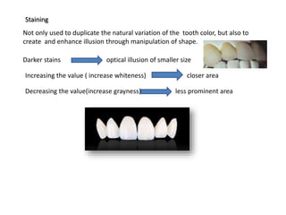 Staining
Not only used to duplicate the natural variation of the tooth color, but also to
create and enhance illusion through manipulation of shape.
Darker stains optical illusion of smaller size
Increasing the value ( increase whiteness) closer area
Decreasing the value(increase grayness) less prominent area
 