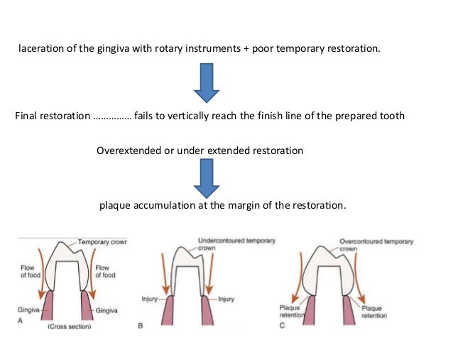 Esthetic considerations. lect