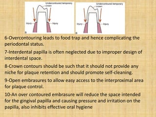 Esthetic considerations. lect 4: part one 2018 -ameer hamdi alameedee | PDF