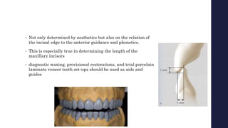 • Not only determined by aesthetics but also on the relation of
the incisal edge to the anterior guidance and phonetics.
• This is especially true in determining the length of the
maxillary incisors
• diagnostic waxing, provisional restorations, and trial porcelain
laminate veneer tooth set-ups should be used as aids and
guides
 