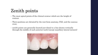 Zenith points
• The most apical points of the clinical crowns; which are the height of
contour.
• Their positions are dictated by the root form anatomy, CEJ, and the osseous
crest,
• zenith points are generally located just distal to a line drawn vertically
through the middle of each anterior tooth (except maxillary lateral incisors)
 