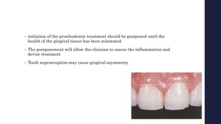 • initiation of the prosthodontic treatment should be postponed until the
health of the gingival tissue has been reinstated.
• The postponement will allow the clinician to assess the inflammation and
devise treatment
• Tooth supraeruption may cause gingival asymmetry
 