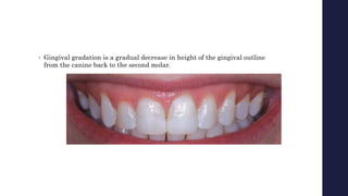 • Gingival gradation is a gradual decrease in height of the gingival outline
from the canine back to the second molar.
 