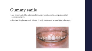 Gummy smile
• can be corrected by orthognathic surgery, orthodontics, or periodontal
osseous surgery.
• Gingival display exceeds 10 mm  only treatment is maxillofacial surgery
 