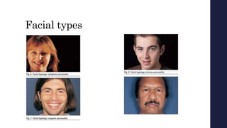 Facial types
 