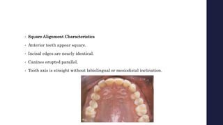 • Square Alignment Characteristics
• Anterior teeth appear square.
• Incisal edges are nearly identical.
• Canines erupted parallel.
• Tooth axis is straight without labiolingual or mesiodistal inclination.
 