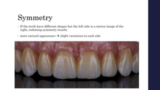 Symmetry
• If the teeth have different shapes but the left side is a mirror image of the
right, radiating symmetry results
• more natural appearance  slight variations to each side
 