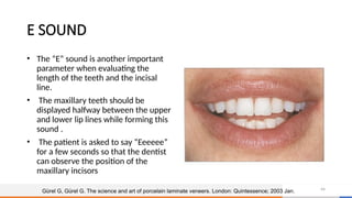 esthetic considerations in fpd new final copy.pptx