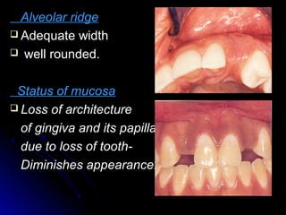 Esthetic considerations in implant placement | PPT