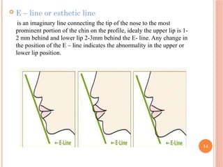 Esthetic dentistry and smile designing in conservative dentistry | PPTX