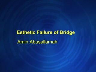 Esthetic Failure of Bridge  Amin Abusallamah 